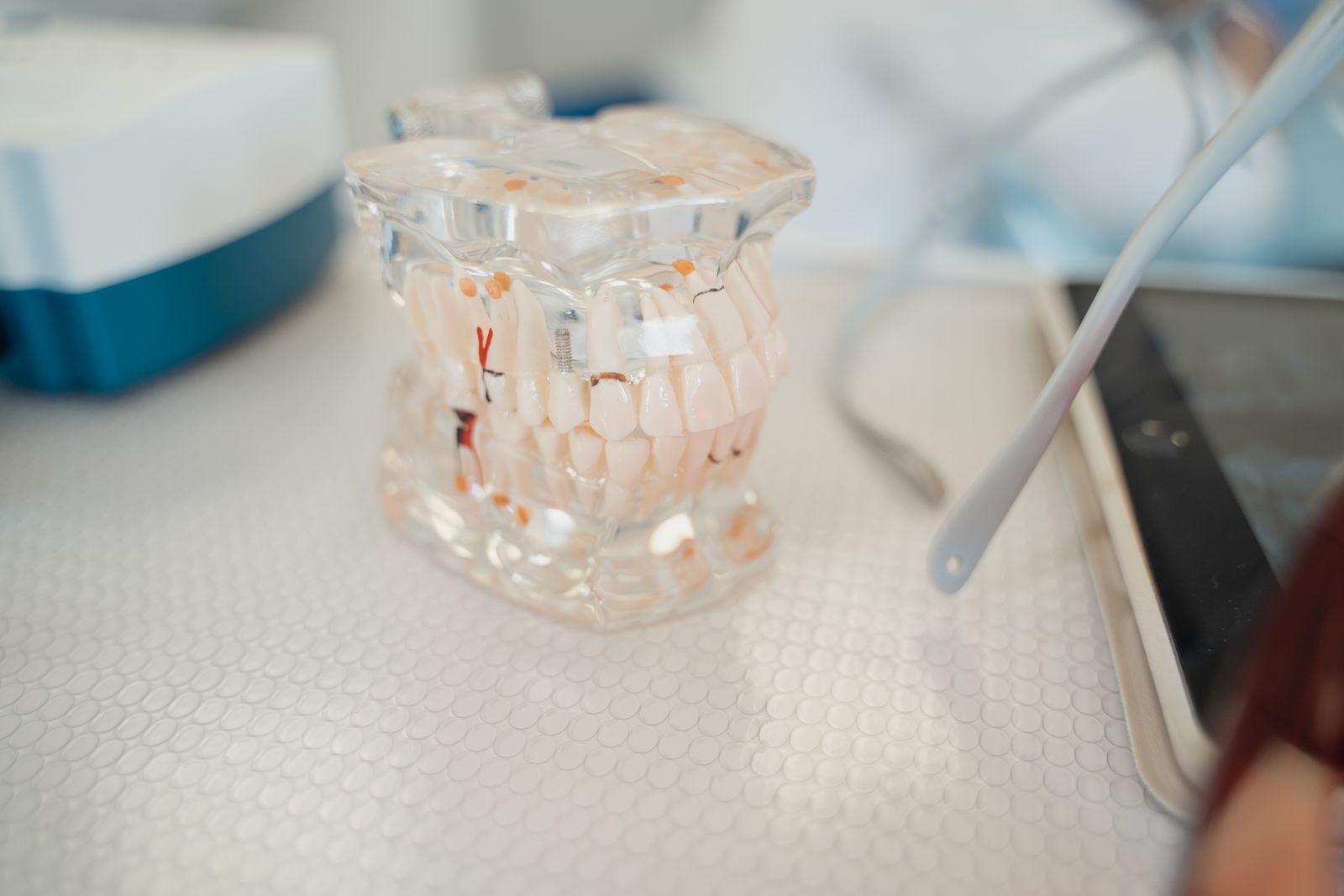 Modèle pédagogique de dentition posé sur un plan de travail